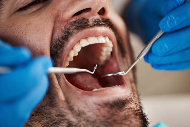 Best Tooth Infection Emergency Dentist  in Lithopolis, OH