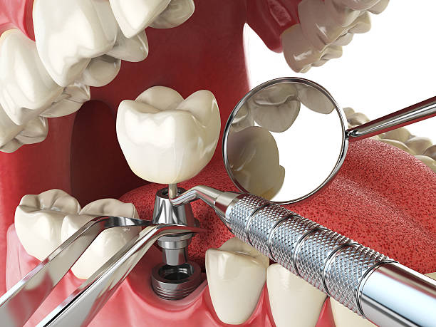 Best Tooth Infection Emergency Dentist  in Lithopolis, OH