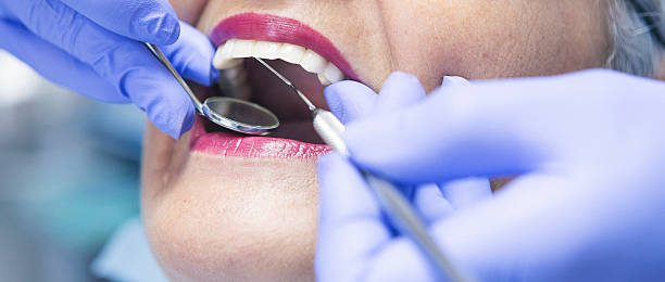 Best Dentist for Tooth Abscess  in Lithopolis, OH